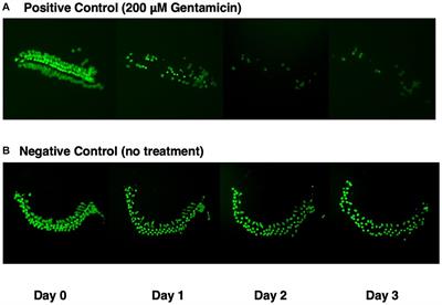 Combinatorial protection of cochlear hair cells: not too little but not too much